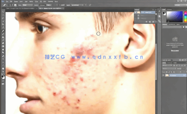 PS人像面部粉刺疤痕瑕疵美容去除处理视频教程(图4)